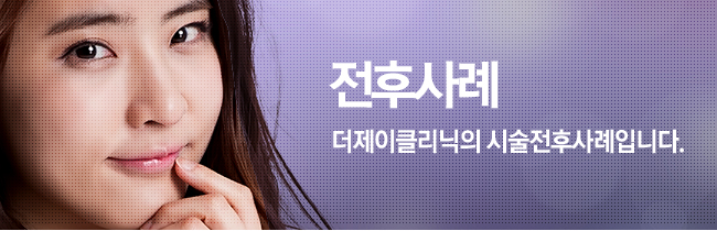 수술전후사례